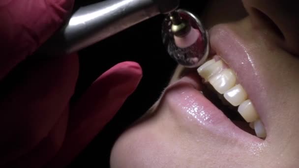 Dentiste faisant le nettoyage des dents pour le patient — Video