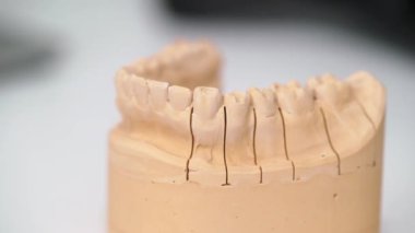 Çene modeli diş Kliniği