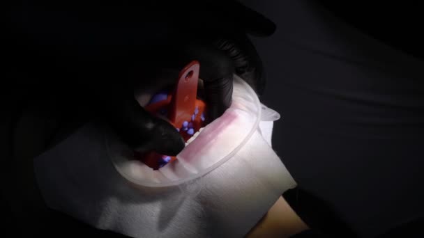 Lekarz dentysta robi stomatologicznych poświaty — Wideo stockowe