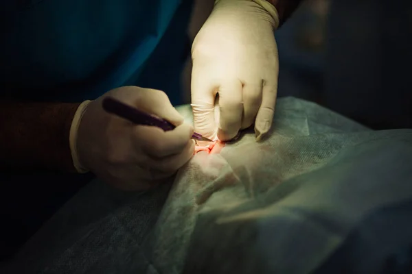 Kirurgen sätter på stygn under kosmetisk plastikkirurgi — Stockfoto