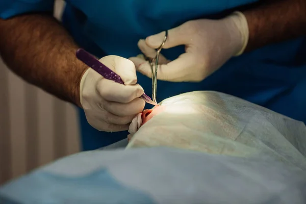 미용 성형 수술 중 바늘에 퍼 팅 하는 외과 의사 — 스톡 사진