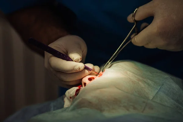 Chirurg, zakładanie szwów podczas estetycznej chirurgii plastycznej — Zdjęcie stockowe