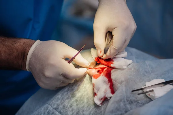 Cirurgião colocando pontos durante a cirurgia plástica estética — Fotografia de Stock