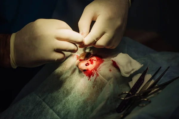 Хирург накладывает швы во время косметической пластической операции — стоковое фото