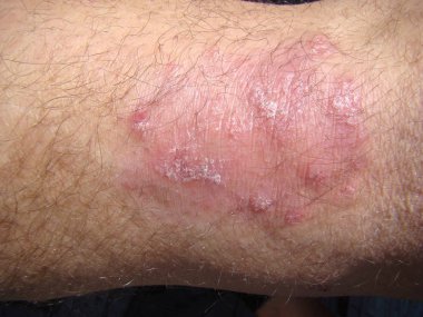 Şeytan'ın sedef gül