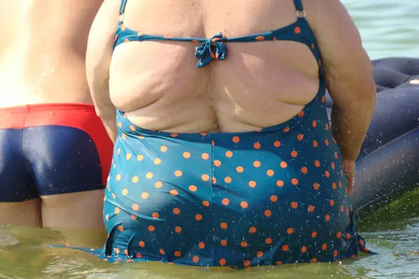 Obezite insan vücudunun