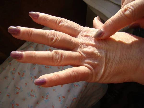 Δέρμα Στο Χέρι Close Γήρανση Του Δέρματος Μακροεντολή — Φωτογραφία Αρχείου