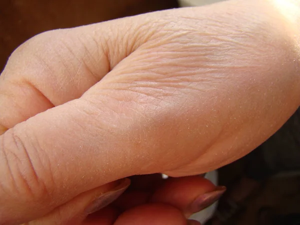 Haut Der Hand Nahaufnahme Alternde Haut Makro — Stockfoto