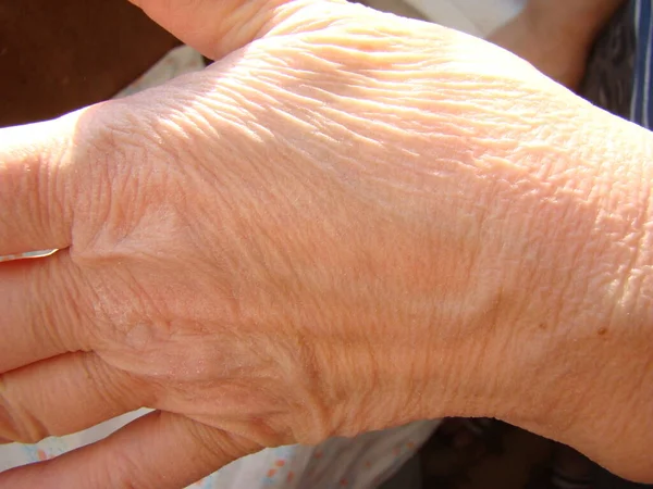 Hud Handen Närbild Åldrande Hud Makro — Stockfoto