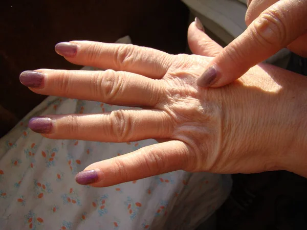 Skin Hand Close Aging Skin Macro — Stock Photo, Image