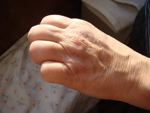 Pele Mão Close Envelhecimento Pele Macro — Fotografia de Stock