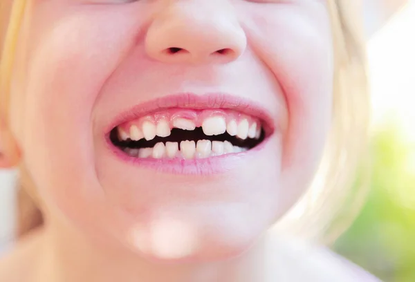 Kid with crooked teeth. Girl show her diastema teeth.