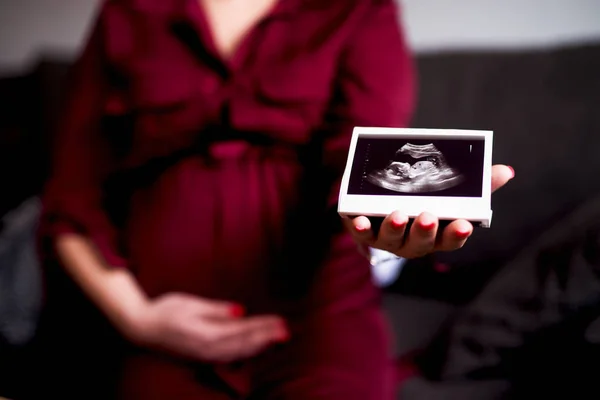 妊娠中の女性の持ち株の超音波検査 — ストック写真
