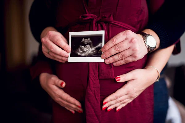Ultrasonografi resim tutan anne — Stok fotoğraf