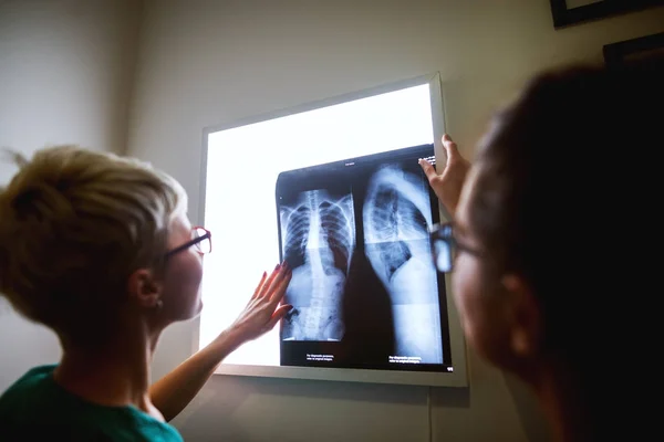 Две Профессиональные Женщины Врача Проверяющие Рентген Больнице — стоковое фото
