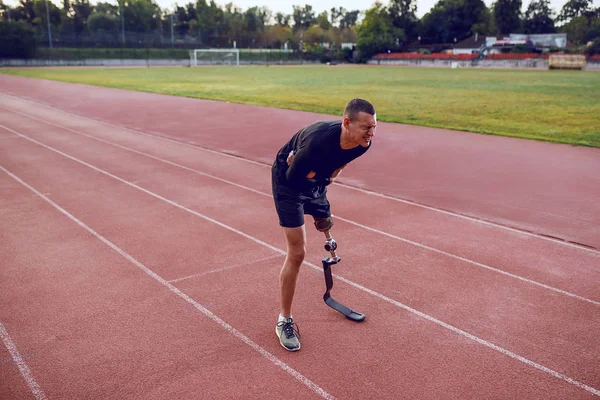 Sportowy Biały Mężczyzna Sztuczną Nogą Stojący Bieżni Bólem Brzucha — Zdjęcie stockowe