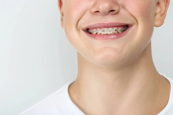 Młody mężczyzna z aparatem dentystycznym na szarym tle — Zdjęcie stockowe