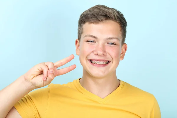 Молодий чоловік з зубними брекетами, що показують два пальці на синьому фоні — стокове фото
