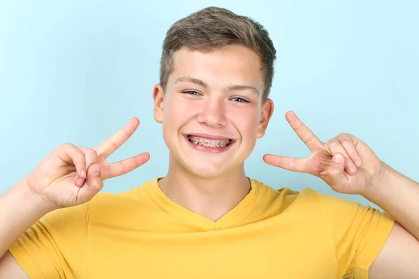 Junger Mann Mit Zahnspange Zeigt Zwei Finger Auf Blauem Hintergrund — Stockfoto