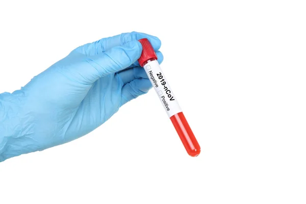 Coronavirus Konsepti Kadın Eli Test Tüpünü Kanla Tutuyor — Stok fotoğraf