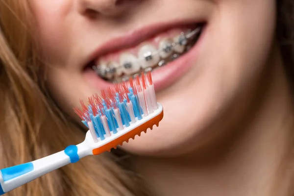 Junges Mädchen mit Zahnspange und Zahnbürste — Stockfoto