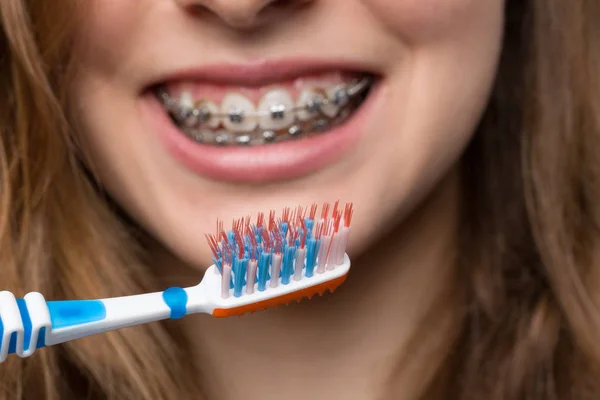 Chica joven con corsé dental y cepillo de dientes — Foto de Stock