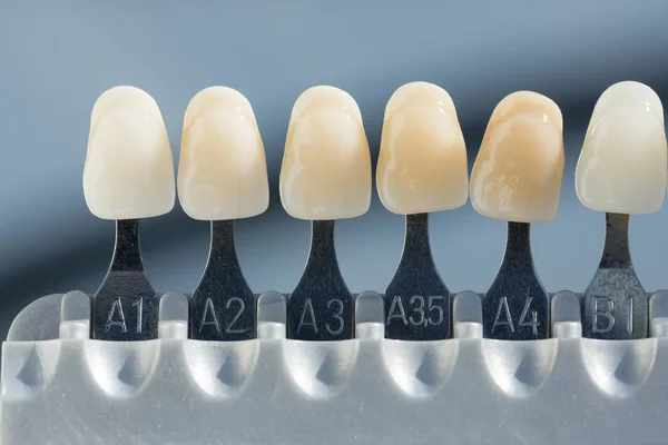 Cieniu przewodnik aby sprawdzić okleina korony zęba w laboratorium dentystyczne — Zdjęcie stockowe