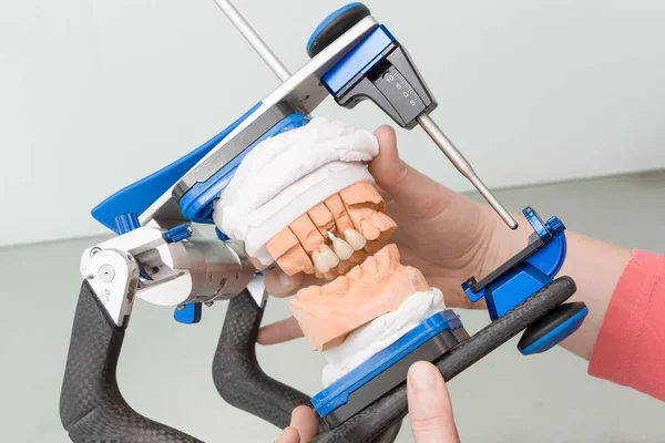 Седло для протеза в стоматологической лаборатории — стоковое фото