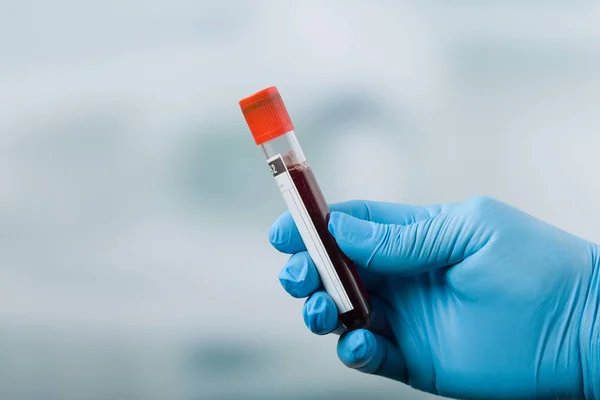 Mano sosteniendo una sonda de sangre — Foto de Stock