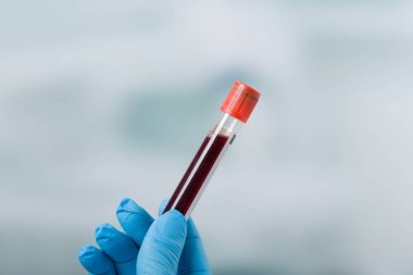 el eldiven ve bir kan sonda ile