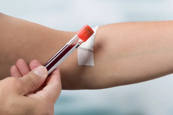 Mão segurando sonda de sangue na frente de um braço — Fotografia de Stock