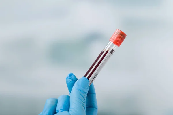 Mão segurando sonda de sangue — Fotografia de Stock