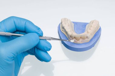 Yapay bir takma diş üzerinde çalışmayı kapat.