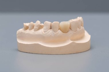 Dental laboratuvardaki suni dentiyle Dental baskı, kullanıma hazır