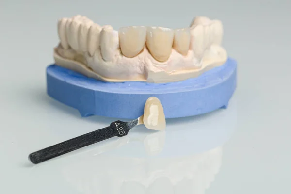 Comprobación de verneer de dentadura postiza en laboratorio dental — Foto de Stock