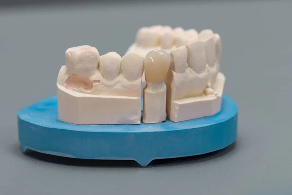 Dental laboratuvardaki suni dentiyle Dental baskı, kullanıma hazır