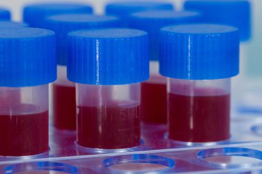 Tüpteki kan örnekleri.