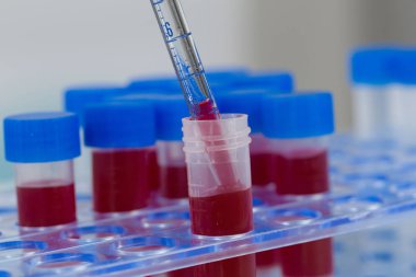 Bir tüp raftaki kan örneklerini doldur.