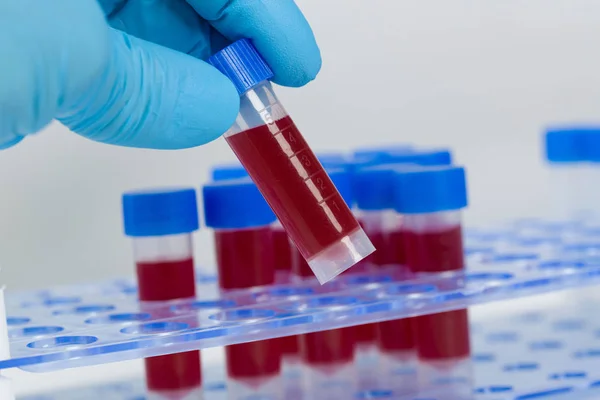 Mano en guantes médicos poner una muestra de sangre en un estante de tubo —  Fotos de Stock
