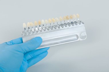 Diş kaplamasını kontrol etmek için diş beyazlatma laboratuarının gölge rehberini kapat.