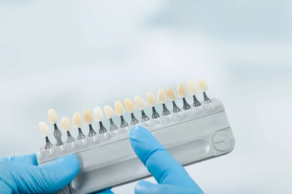 Närbild på skugga guide att kontrollera faner av tanden krönar i ett tandtekniskt laboratorium — Stockfoto