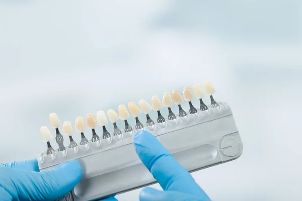 Primer plano de la guía de sombra para comprobar la chapa de la corona dental en un laboratorio dental — Foto de Stock