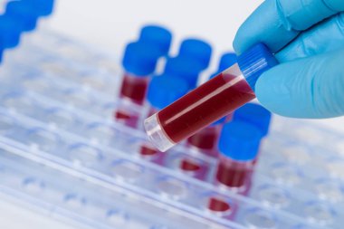 Tıbbi eldivenleri giyip tüp rafından insan kanı örneği alacağız.