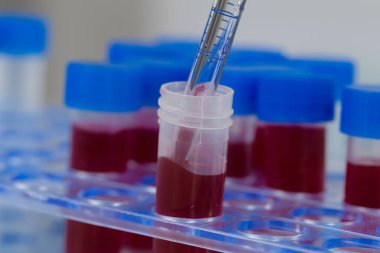 Kan örnekleri ve tüp rafında bir pipet.