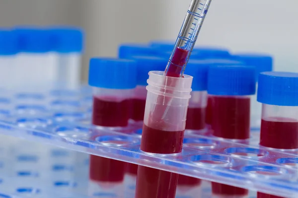 Bekerja dengan sampel darah di rak tabung — Stok Foto