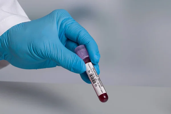 Human Blood Samples Tube Rack — 스톡 사진