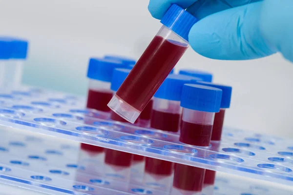 Mão em luvas médicas obter amostra de sangue humano fora de um rack de tubo — Fotografia de Stock