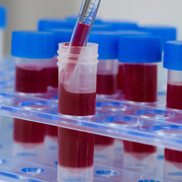 Human blood samples in a tube rack with a pipette — 스톡 사진