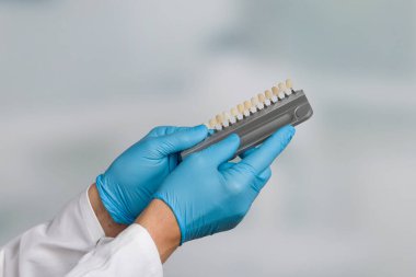 Diş kaplamasını kontrol etmek için diş beyazlatma laboratuarının gölge rehberini kapat.