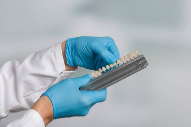 Diş kaplamasını kontrol etmek için diş beyazlatma laboratuarının gölge rehberini kapat.